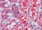 Goat Anti-SOCS1 Antibody